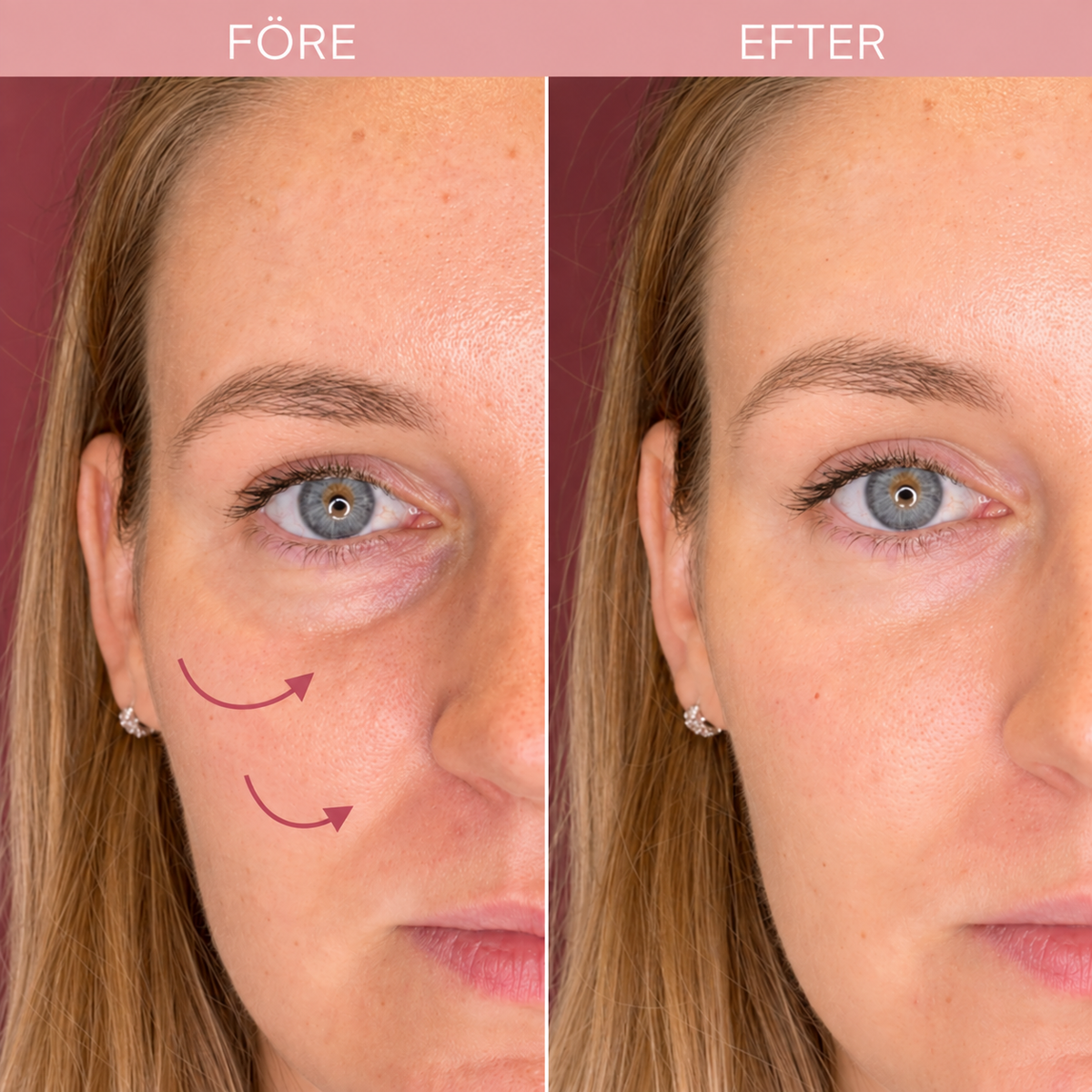 K-Beauty Under Eye Glow