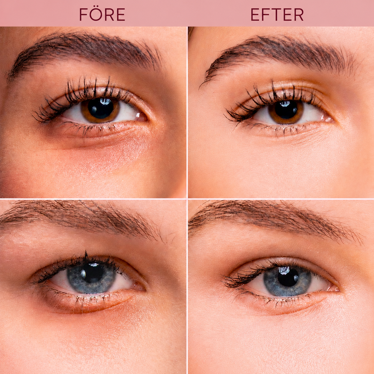 K-Beauty Under Eye Glow